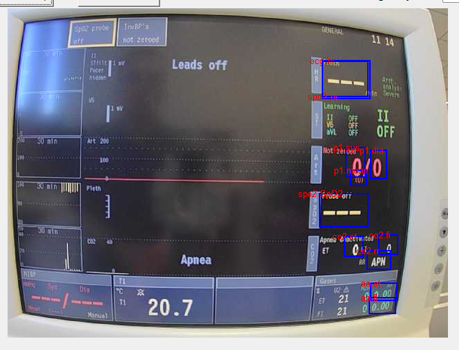 Image for the Anaesthesia OCR Project